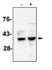 "
Western blot analysis
using caspase-7
antibody on MCF-7 cells
treated with thapsigargin
for 48 hours which are
negative (-) and positive
(+) for caspase-3."